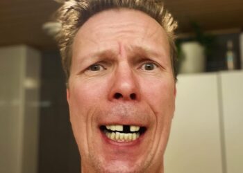 jukka rasila hampaat